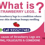 Strawberry LEgs