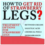 Strawberry Legs